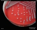 escherichia coli